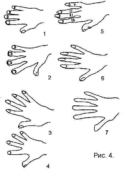 Типы рук